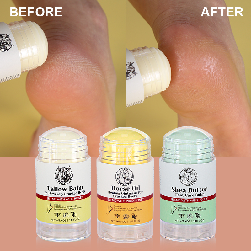 Beeswax Dead Skin Foot Callus Remover Foot Cream Care Stick Cracked Heel Repair Whipped Beef Tallow for Dry Feet - 13